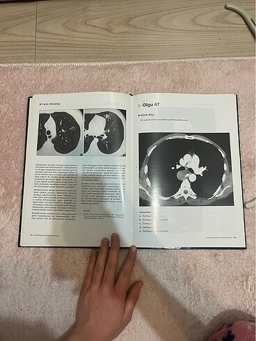 Bilgisayarlı tomografi atlası toraks
