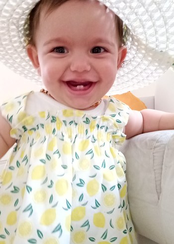 Diğer Sarı Baskılı Fırfırlı Bebek Elbisesi