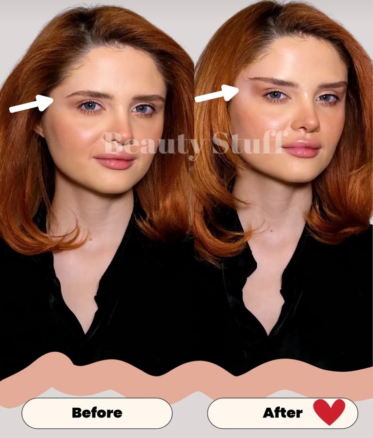 Yüz ve göz germe bandı ve görünmez çift göz kapağı bandı - Görsel 5