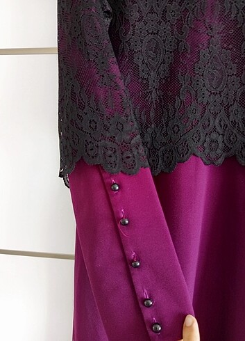 Dantel detaylı elbise  - Görsel 2