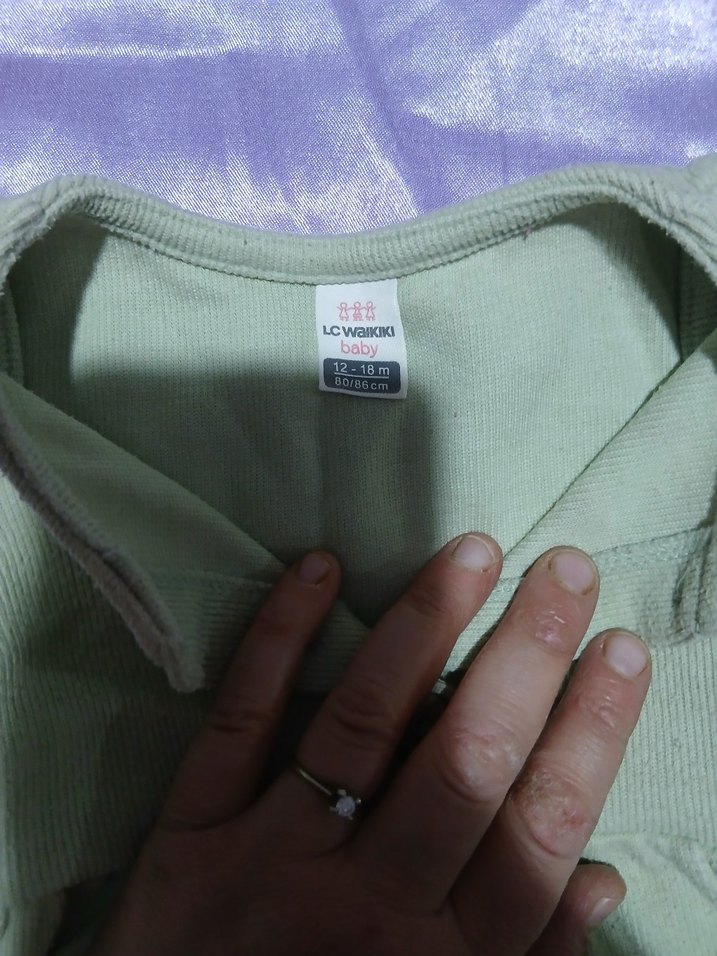 Düğmeli Yeşil Kolsuz Kız Elbisesi - Görsel 4