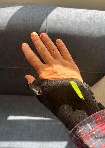 Medikal Tetik Parmak Eldiveni - Görsel 2