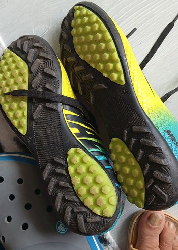 Sarı Erkek  Spor Ayakkabı Velcro - Görsel 7