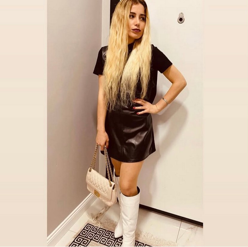 Siyah Yılan Derisi Desenli Kısa Deri Elbise - Görsel 2