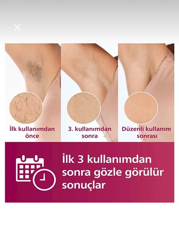 PHİLİPS LUMEA PRESTİGE IPL BRI950/00 LAZER EPİLASYON CİHAZI - Görsel 8