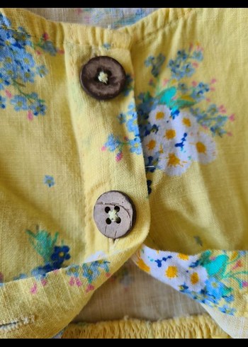 Sarı Çiçekli Kız Çocuk Düğmeli Elbise - Görsel 2