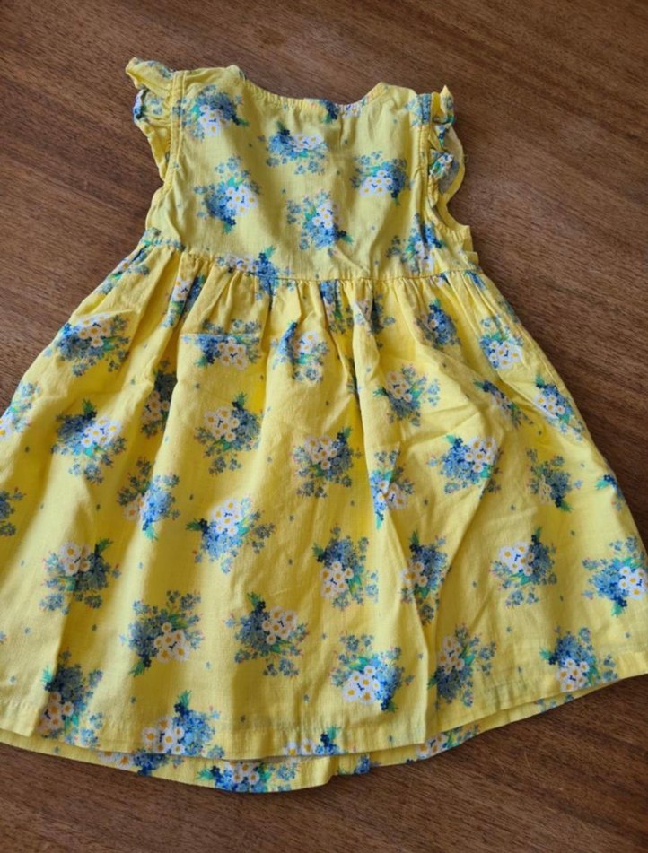 Sarı Çiçekli Kız Çocuk Düğmeli Elbise - Görsel 4