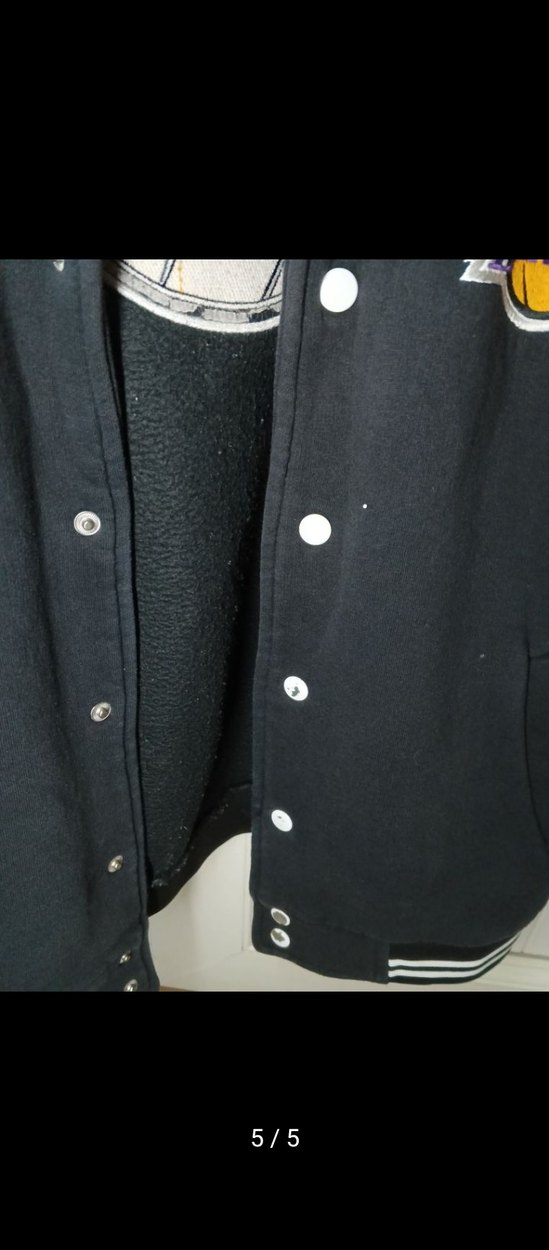 Siyah Baskılı Düğmeli Ceket - Görsel 5