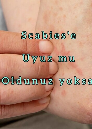 Katranlı Kükürt Kremi