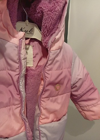 Kız Çocuk Pembe Düğmeli Ceket - Görsel 2