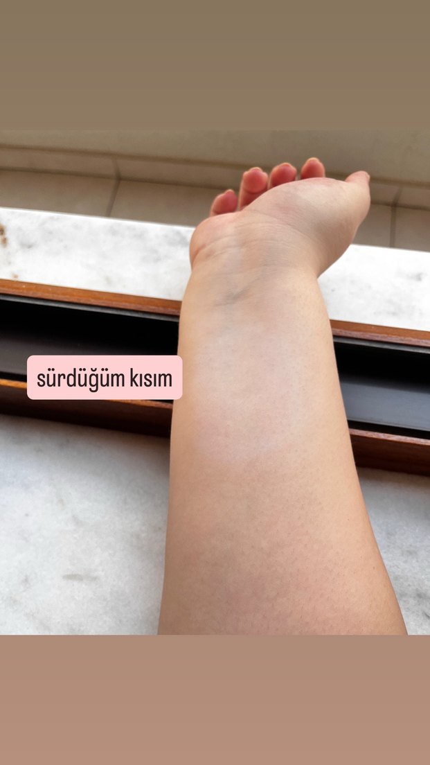 Beyazlatıcı ve Maderise krem - Görsel 2