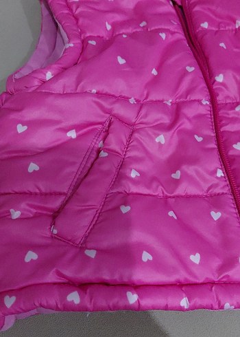 Kız Çocuk Pembe Fermuarlı Yelek - Görsel 2