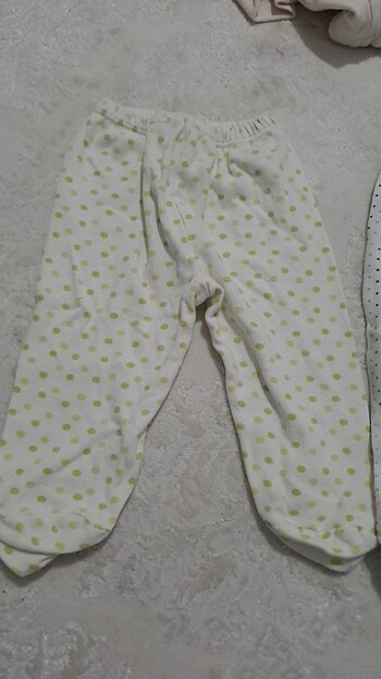 Yenidoğan - Görsel 2