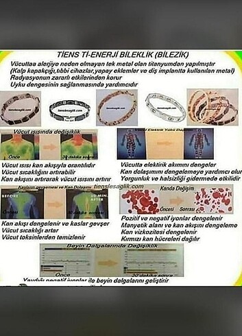 Beden siyah Renk Tiens Ti-Enerji Bileklik