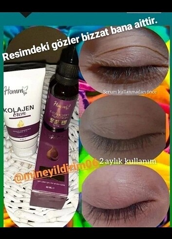  Beden Hom bitkisel 