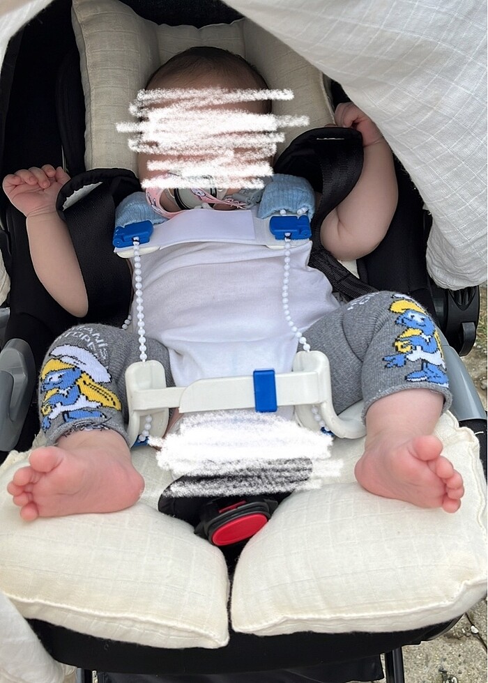 Tübingen kalça ortezi - Görsel 2