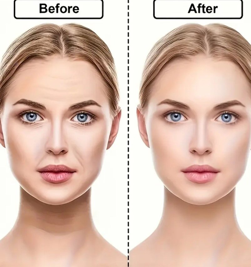 Yüz Kırışıklık Karşıtı Bant Seti - Görsel 5