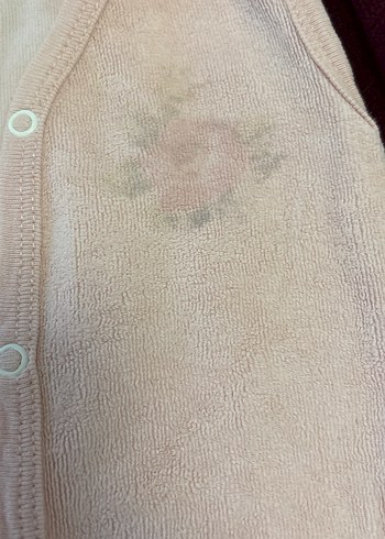 Kız Çocuk Pembe Düğmeli Yelekler - Görsel 4