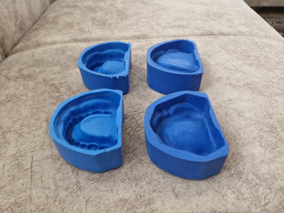 Fantom silikon diş kalıpları - Görsel 2