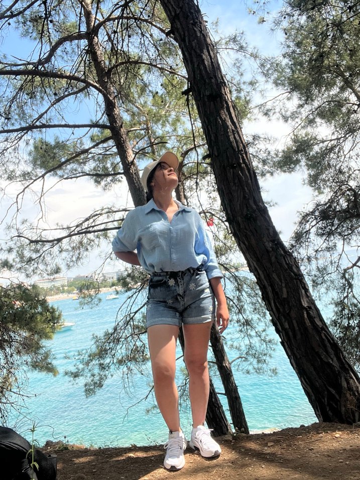 Kadın Beli Kemerli Açık Mavi Batik Bermuda Şort - Görsel 2