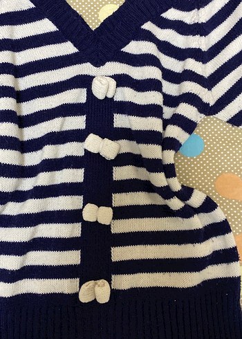 Düğmeli V Yaka Çizgili Mavi Triko Hırka - Görsel 2