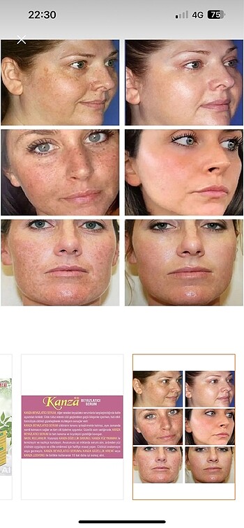 Kanza beyazlatıcı krem - Görsel 5