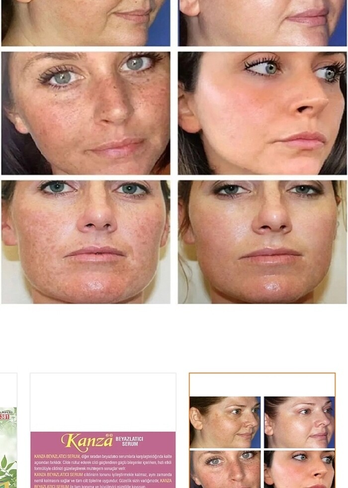 Kanza beyazlatıcı krem - Görsel 5