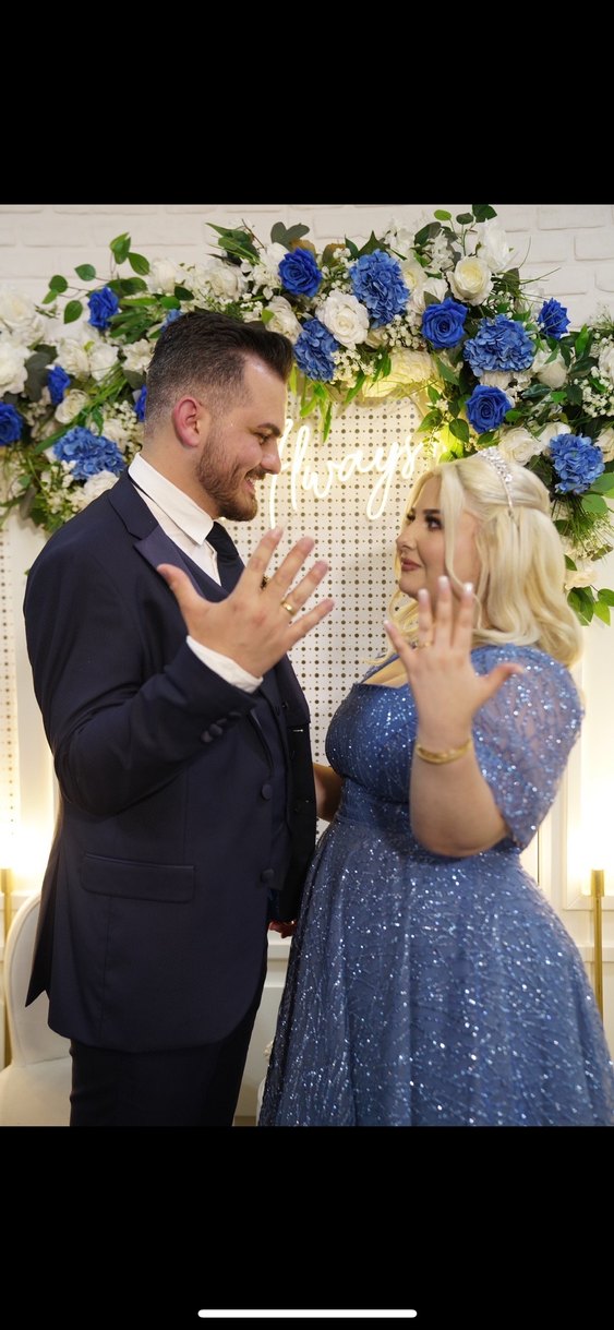 Mavi Dantel Midi Parti Elbisesi - Görsel 2