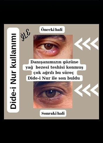 Her derde deva - Görsel 8