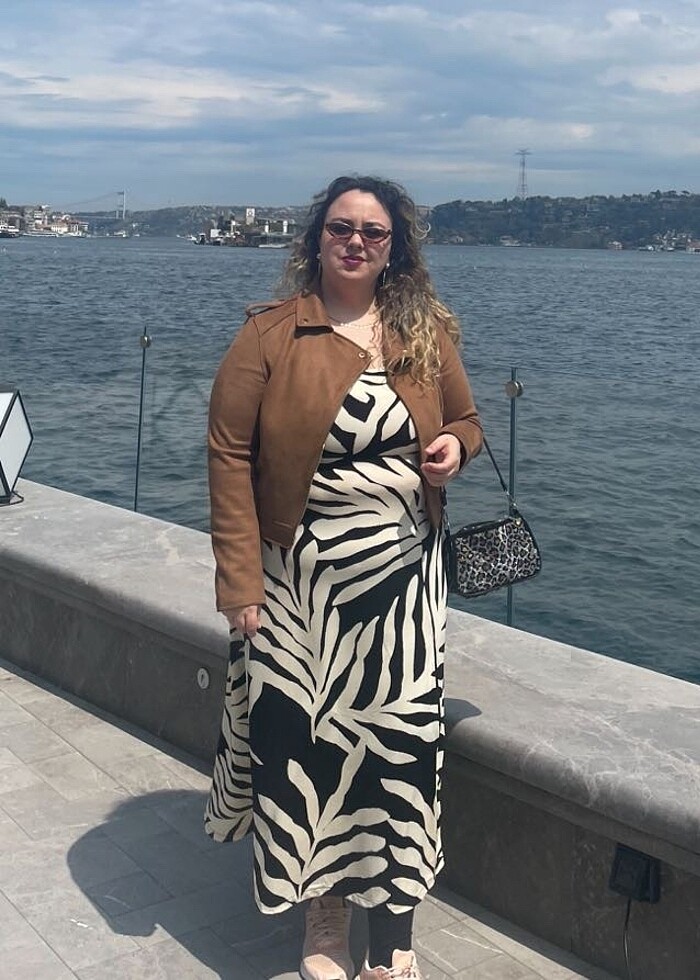 Zebra Desen H&M Elbise - Görsel 3