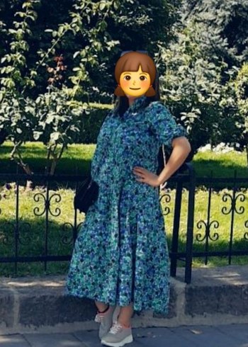 Renkli Batik Midi Elbise, Kısa Kollu, Salaş Kesim - Görsel 3