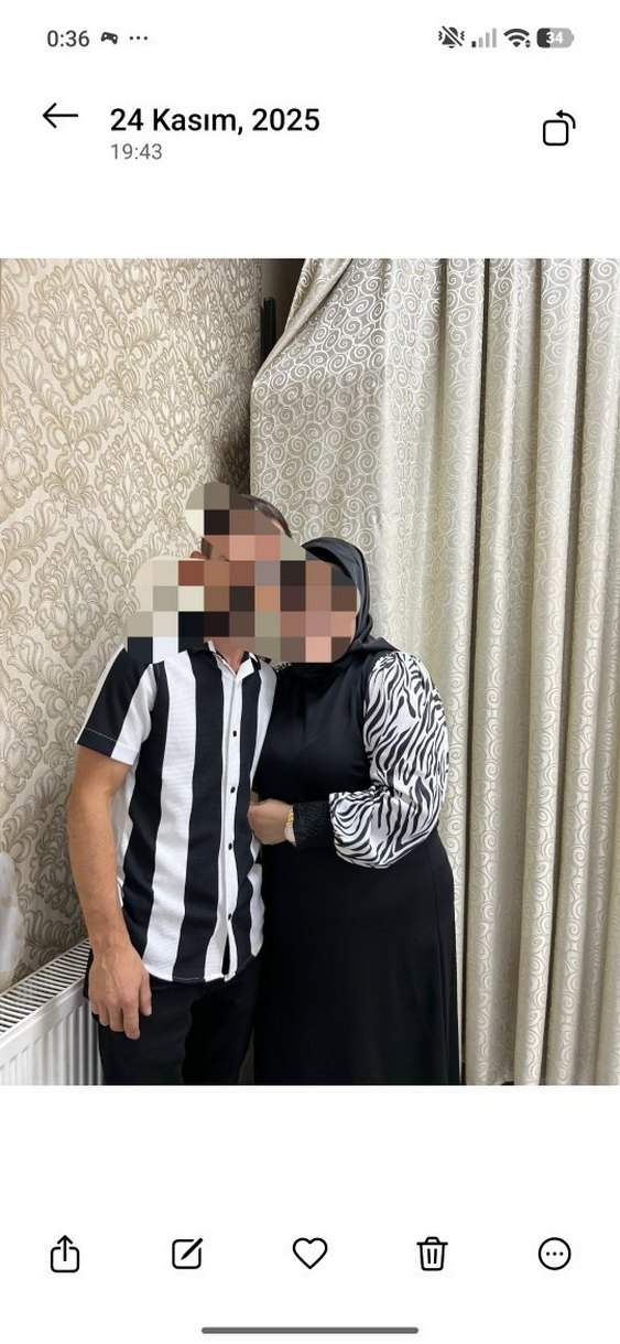 Siyah Zebra Desenli Uzun Kollu Midi Elbise - Görsel 3