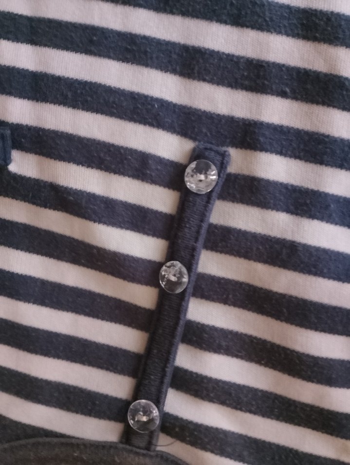 Düğmeli Kısa Kollu Gri Çizgili Tişört - Görsel 2