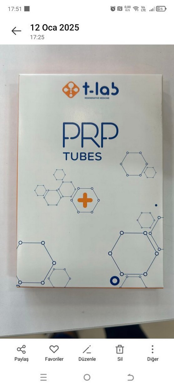 T-lab PRP Tüpleri 1 kutu 2 adet - Görsel 4