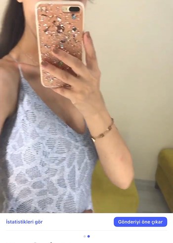 V Yaka Dantel İşlemeli Bebe Mavisi Elbise - Görsel 3