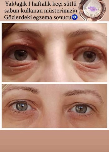 Gano Transparent Soap - Cilt Bakım Sabunu 100g - Görsel 2