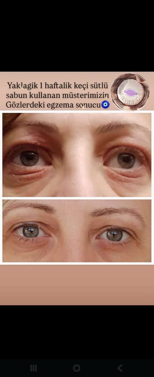 Gano Transparent Soap - Cilt Bakım Sabunu 100g - Görsel 2