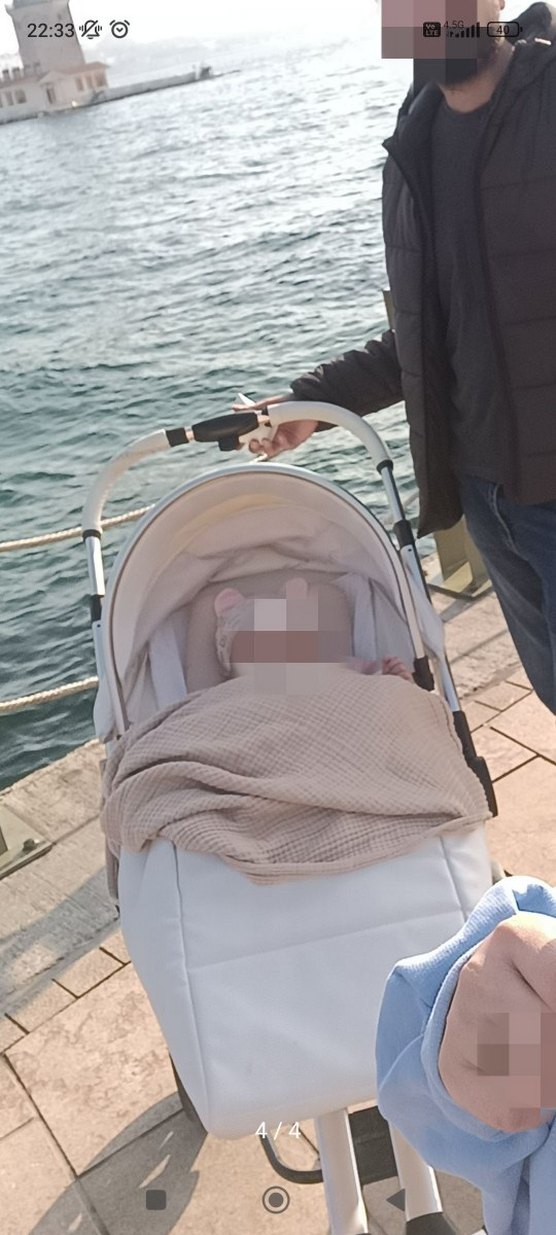 Yoyko Capsule Egg Travel Sistem Bebek Arabası Gri - Görsel 5