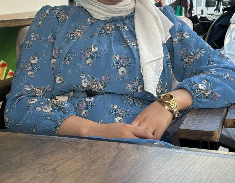 Mavi Çiçek Desenli Elbise - Görsel 2