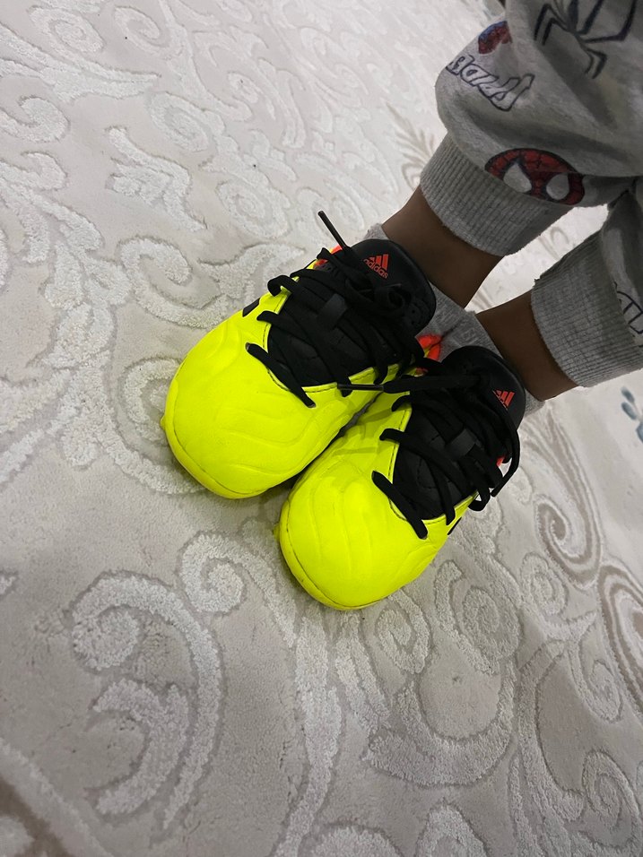 Sarı Adidas Erkek Futbol Ayakkabısı - Görsel 2