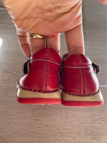 Ortopedik bebek ayakkabısı - Görsel 3