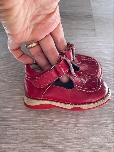 Ortopedik bebek ayakkabısı - Görsel 2