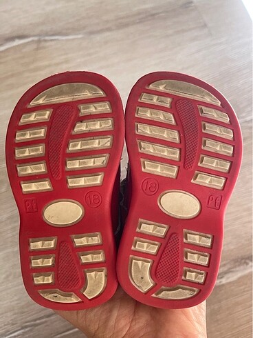 Ortopedik bebek ayakkabısı - Görsel 4