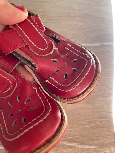 Ortopedik bebek ayakkabısı - Görsel 6
