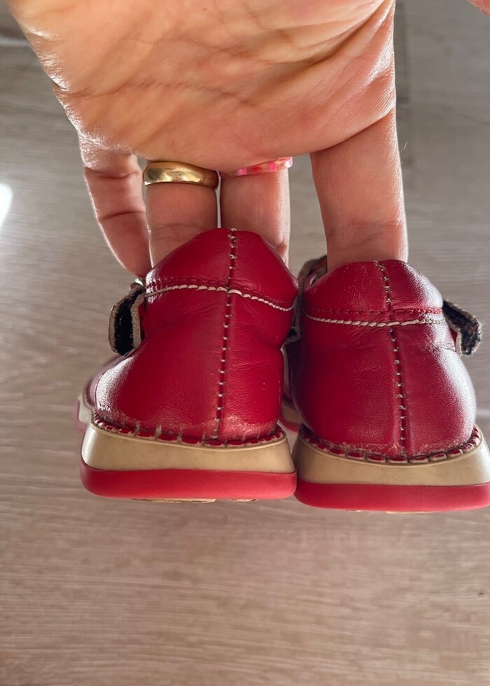 Ortopedik bebek ayakkabısı - Görsel 3