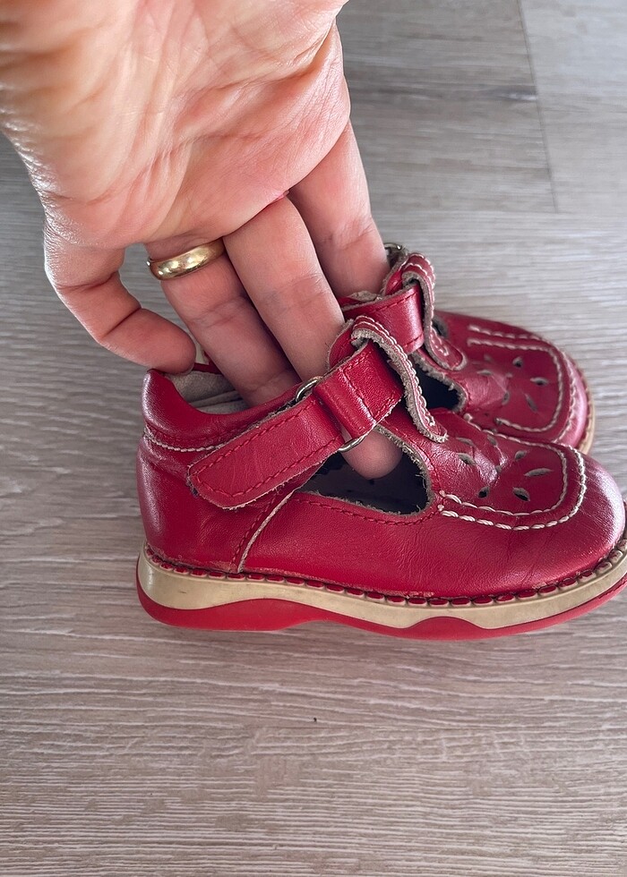 Ortopedik bebek ayakkabısı - Görsel 2