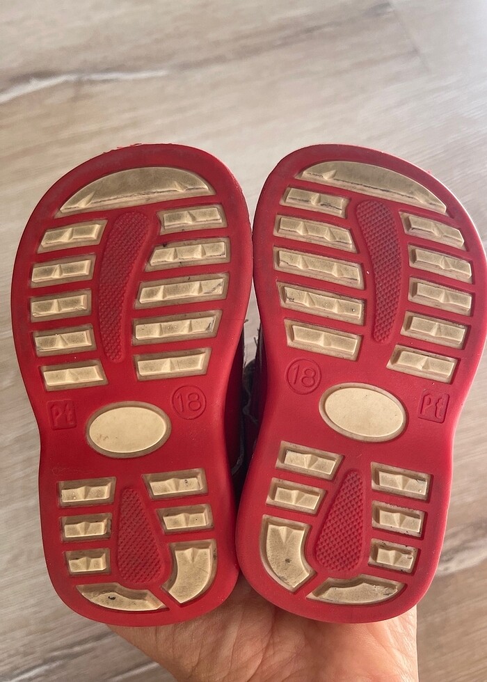 Ortopedik bebek ayakkabısı - Görsel 4