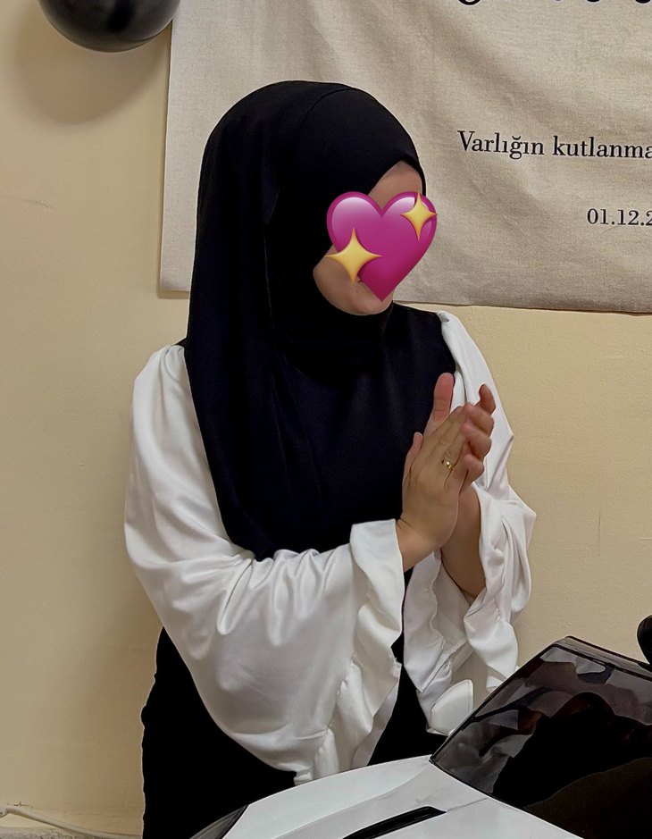 Uzun Siyah Beyaz Kol Detaylı Elbise - Görsel 4