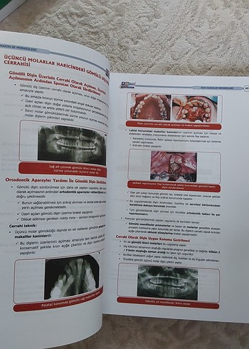  Dusdata Ağız, Diş ve Çene Cerrahisi Sınav Hazırlık Kitabı
