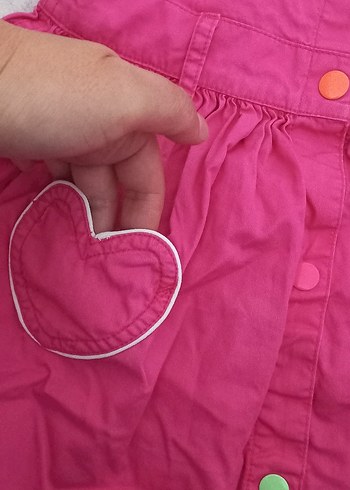 Renkli Düğmeli Kız Çocuk Elbisesi slopet - Görsel 2